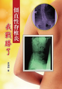 僵直性脊椎炎我戰勝了